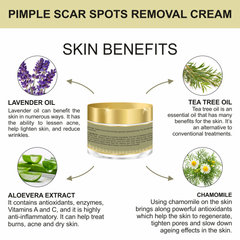 Anti Acne Cream 50GM